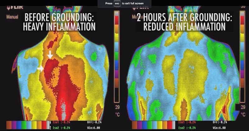 Inflammation level before and after grounding