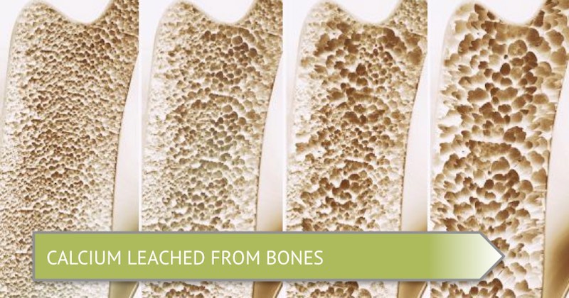 Bone density 