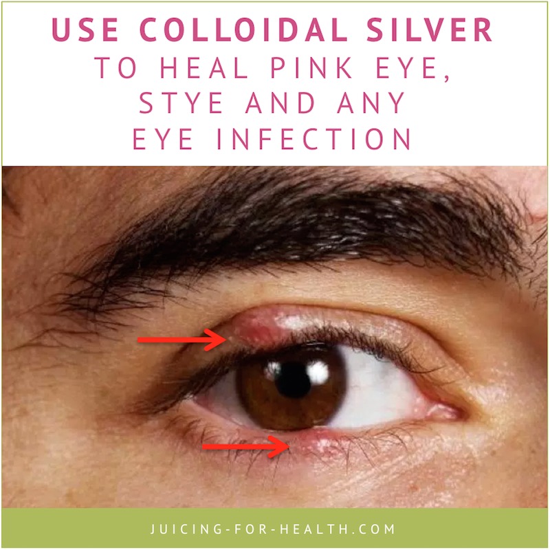 colloidal silver heal eye infections
