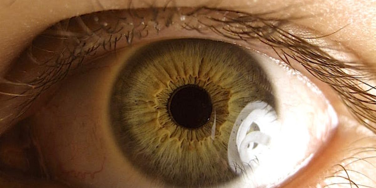 Study: Turmeric Eye Drops May Treat And Reduce Glaucoma Symptoms