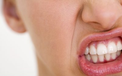 Bruxism: How To Stop Teeth Grinding Naturally (It's Not Just Stress)