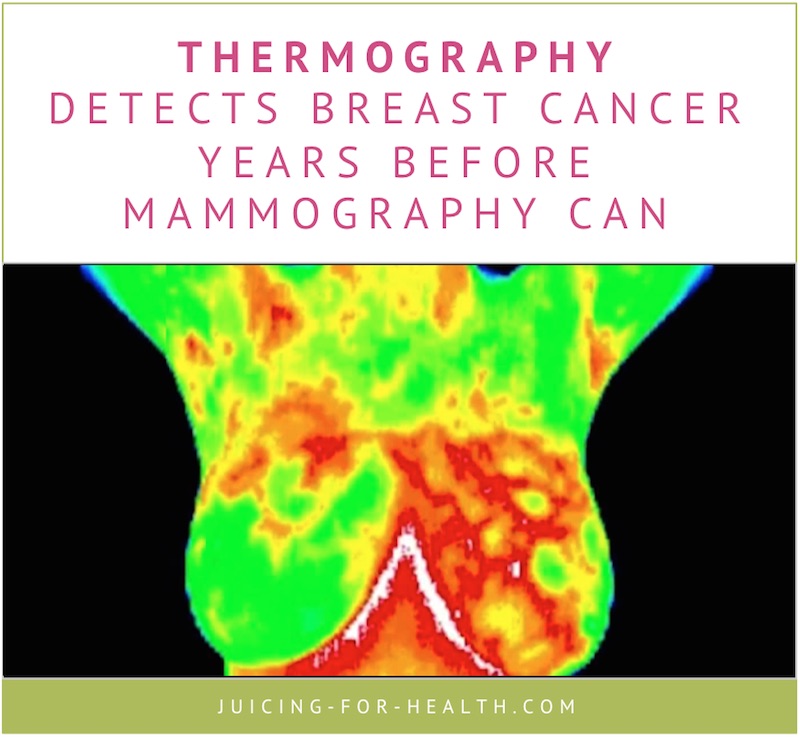 thermography for breast cancer screening