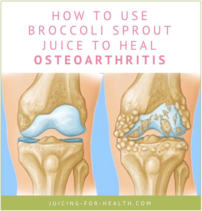 sulforaphane to heal arthritis joints