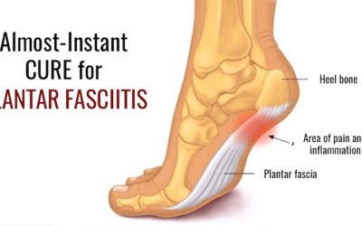 Almost-Instant Cure For Plantar Fasciitis That They Don’t Tell You About