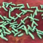 Flesh-Eating Bacteria Leaves Eight People Dead as Cases Rise Amid Health Warning