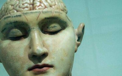 Calcification of the Pineal Gland Shows a Strong Correlation in the Developing of Alzheimer’s Disease