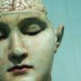 Calcification of the Pineal Gland Shows a Strong Correlation in the Developing of Alzheimer’s Disease
