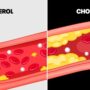 The Carnivore Diet Made Cholesterol Ooze From This Guy’s Hands
