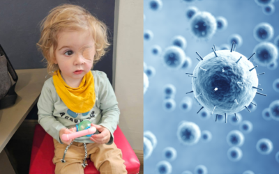 Two-Year-Old Boy Loses His Eye Sight After Being Kissed by Someone With Herpes Virus
