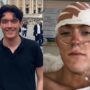 I Was Diagnosed With a Deadly Cancer at Just 27 -Here Are the Early Symptoms I Experienced
