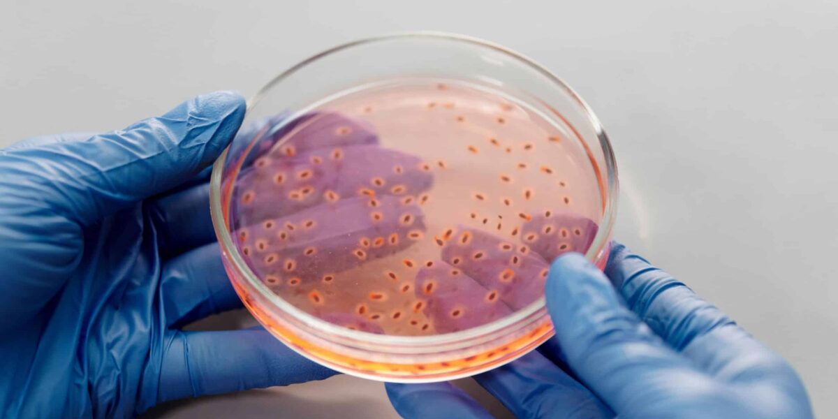 Dysentery Outbreak in Oregon Leaves at Least 40 Sickened