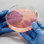 Dysentery Outbreak in Oregon Leaves at Least 40 Sickened