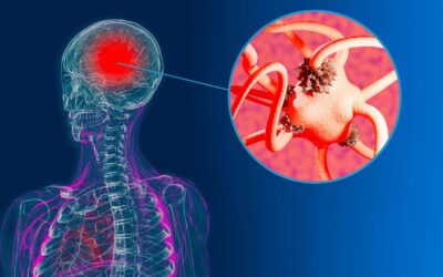 Study Claims Use Of Marijuana Could Lead To Potential Dementia Diagnosis Within The Next 5 Years