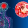 Study Claims Use Of Marijuana Could Lead To Potential Dementia Diagnosis Within The Next 5 Years