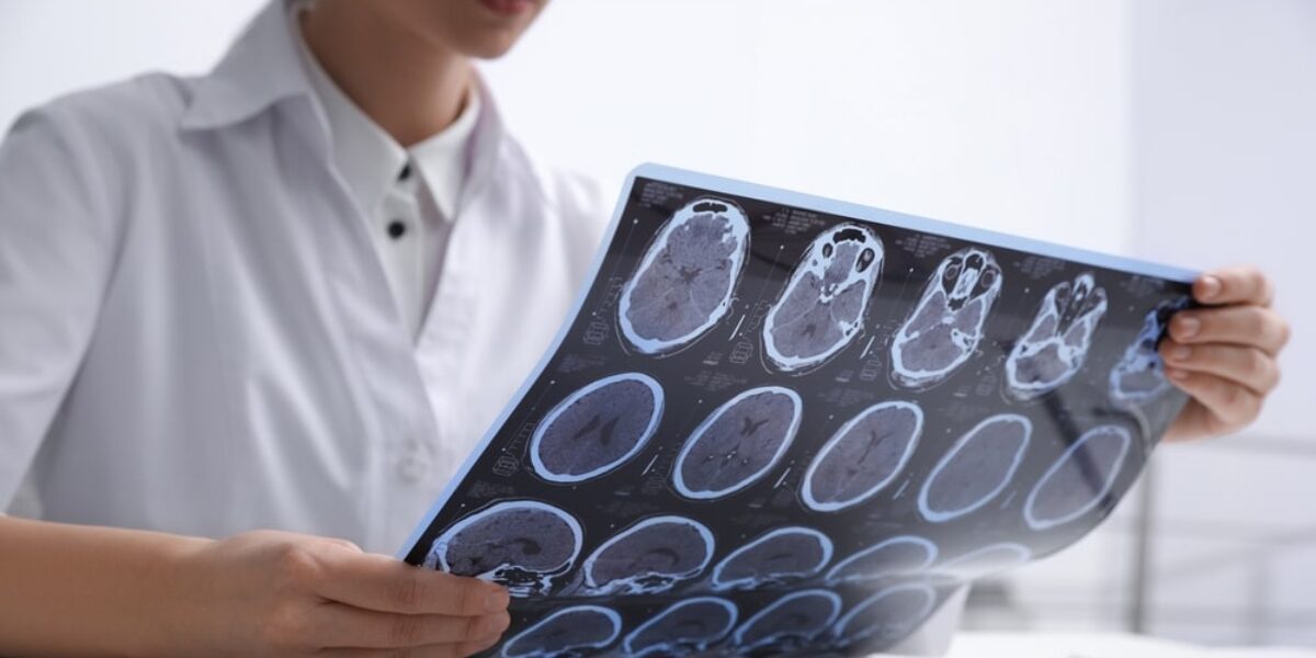 We Might Know What Causes Multiple Sclerosis and Have a Vaccine in the Works