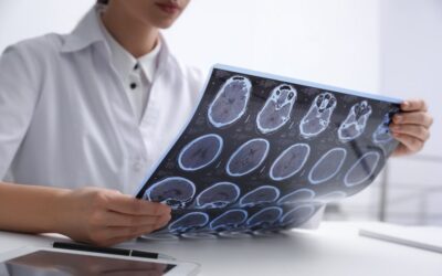 We Might Know What Causes Multiple Sclerosis and Have a Vaccine in the Works