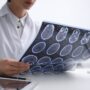 We Might Know What Causes Multiple Sclerosis and Have a Vaccine in the Works