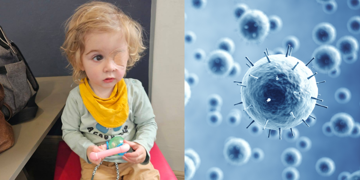Two-Year-Old Boy Loses His Eye Sight After Being Kissed by Someone With Herpes Virus