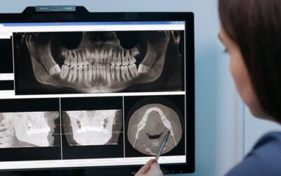 Poor Dental Hygiene Linked to Shrinkage of the Hippocampus, the Brain’s Memory Center