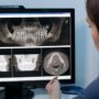 Poor Dental Hygiene Linked to Shrinkage of the Hippocampus, the Brain’s Memory Center