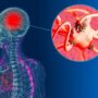 Study Claims Use Of Marijuana Could Lead To Potential Dementia Diagnosis Within The Next 5 Years