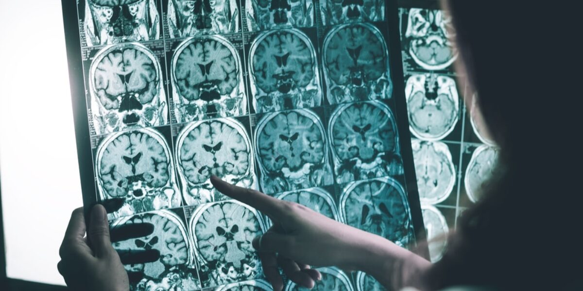 Woman, 30, Diagnosed With Brain Tumor After Telling Her Doctor About Common Symptom