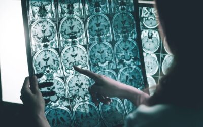 Woman, 30, Diagnosed With Brain Tumor After Telling Her Doctor About Common Symptom