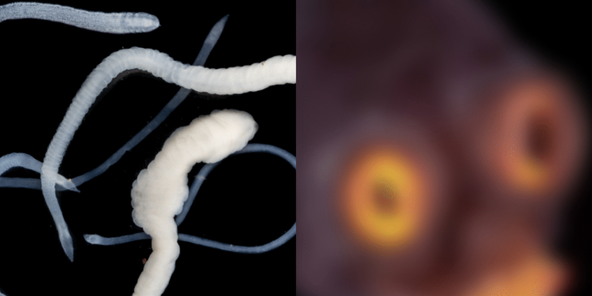 “People Stunned by What a Tapeworm Looks Like Under the Microscope”