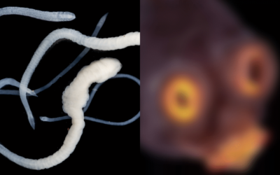 “People Stunned by What a Tapeworm Looks Like Under the Microscope”