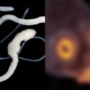 “People Stunned by What a Tapeworm Looks Like Under the Microscope”