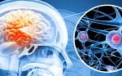 Japanese Scientists achieve breakthrough in Parkinson Treatment by successfully implanting Lab Grown Brain Cell in patients.