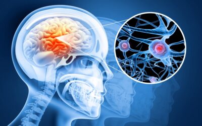 Groundbreaking Nanoparticle Technology Reverses Parkinson’s Disease in Stunning Study