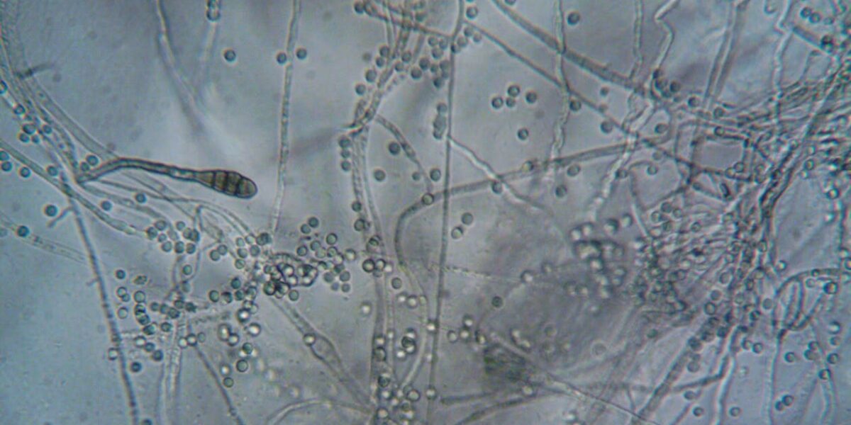 Five US States Brace for Deadly Airborne Fungus That Destroys Human Tissue