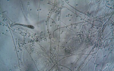 Five US States Brace for Deadly Airborne Fungus That Destroys Human Tissue