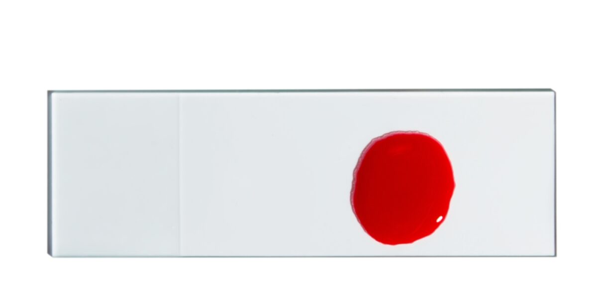 Scientists Discover New Blood Type Only Found In One Woman On Earth Today