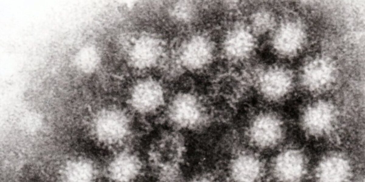 Highly Contagious Stomach Virus Cases Double in the Midwest Ahead of Holidays