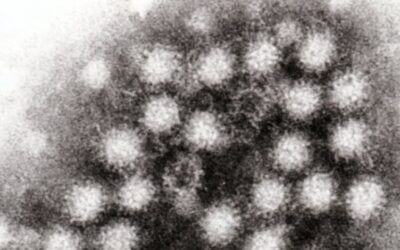 Highly Contagious Stomach Virus Cases Double in the Midwest Ahead of Holidays