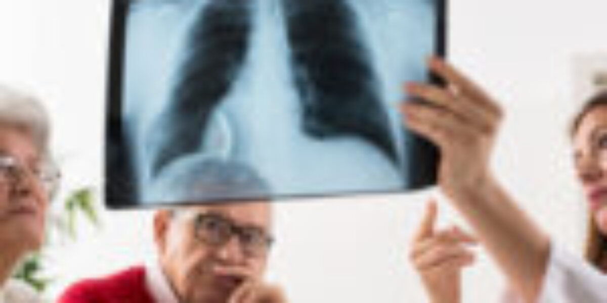 A Deadly Post COVID Syndrome Doctors Never Saw Coming