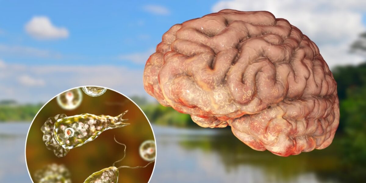 Brain Eating Amoeba Infections Are Increasing, Researchers Warn of Global Unpreparedness