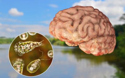 Brain Eating Amoeba Infections Are Increasing, Researchers Warn of Global Unpreparedness