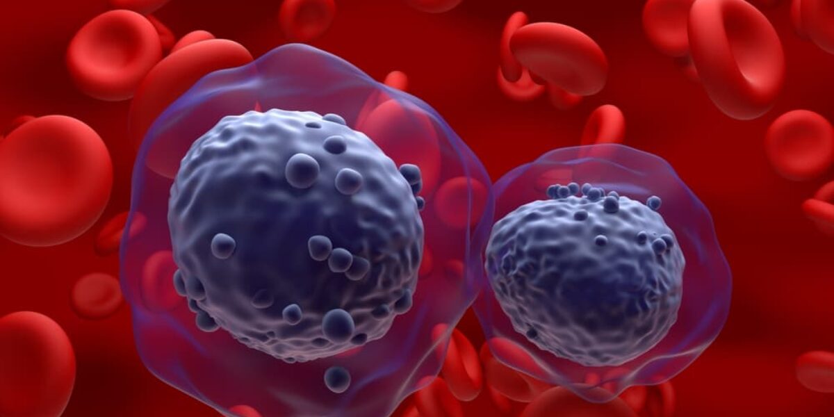 Acute Myeloid Leukemia Symptoms to Recognize Following Tatiana Schlossberg’s Death