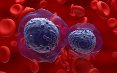 Acute Myeloid Leukemia Symptoms to Recognize Following Tatiana Schlossberg’s Death